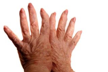 arthritis treatment in PUNE Card image cap
