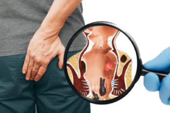 piles treatment in PUNE Card image cap